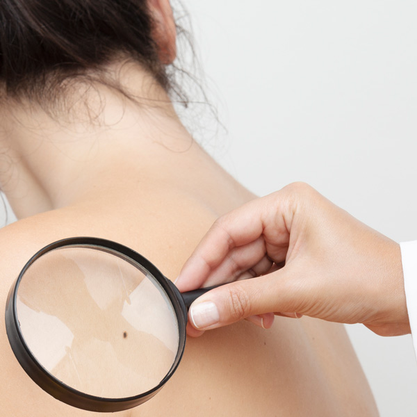 skin inspection with magnifying glass