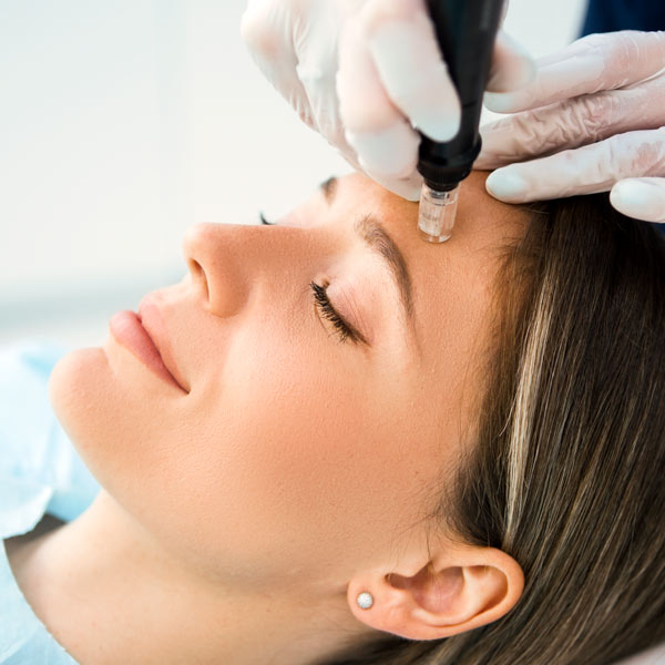 derma pen being used on face